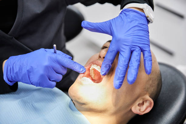 Best Emergency Dental Care for Broken or Chipped Teeth in St Anthony, ID